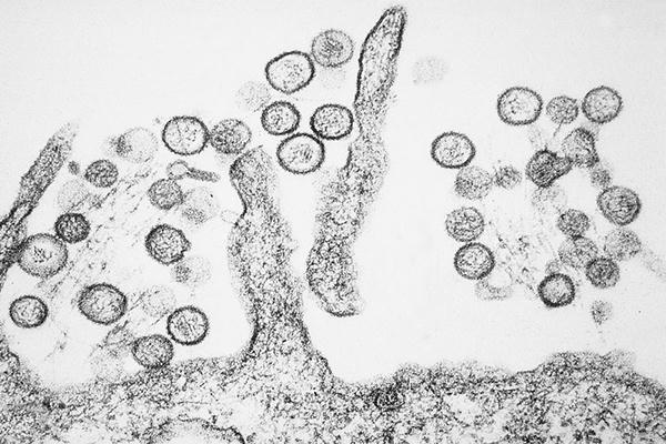 Bộ Y tế thông tin về bệnh do virus Hanta