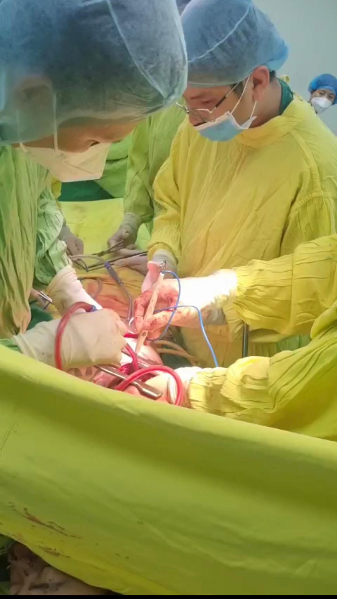 Ê - kíp phẫu thuật gồm nhiều bác sĩ đa chuyên khoa phối hợp.