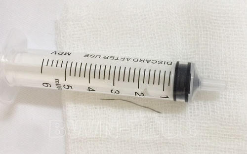 Đoạn dây thép được lấy ra khỏi cổ họng của cụ bà 77 tuổi. Ảnh: BV cung cấp.