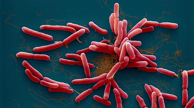 Vi khuẩn Burkholderia pseudomallei gây bệnh Whitmore.  