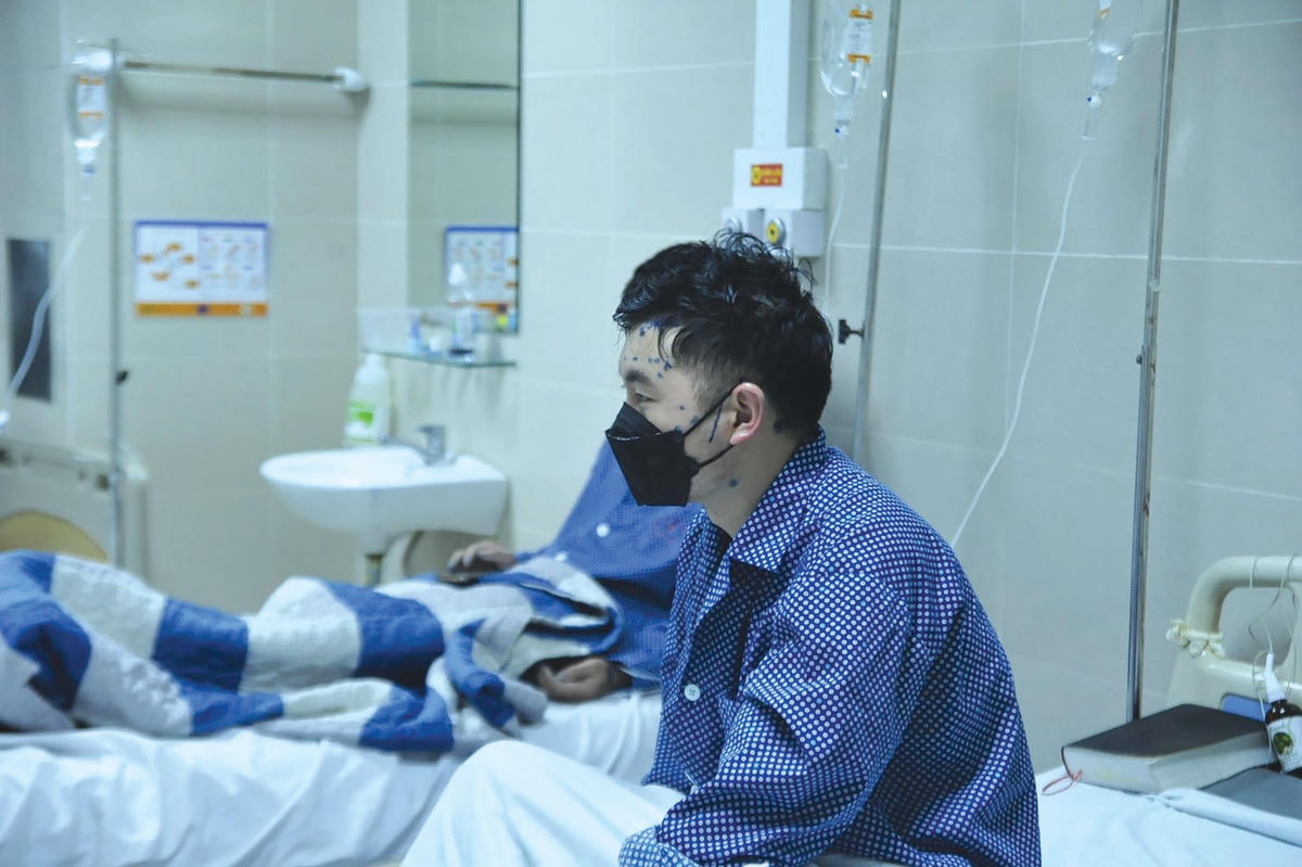 Bệnh nhân mắc thủy đậu gia tăng tại Hà Nội.