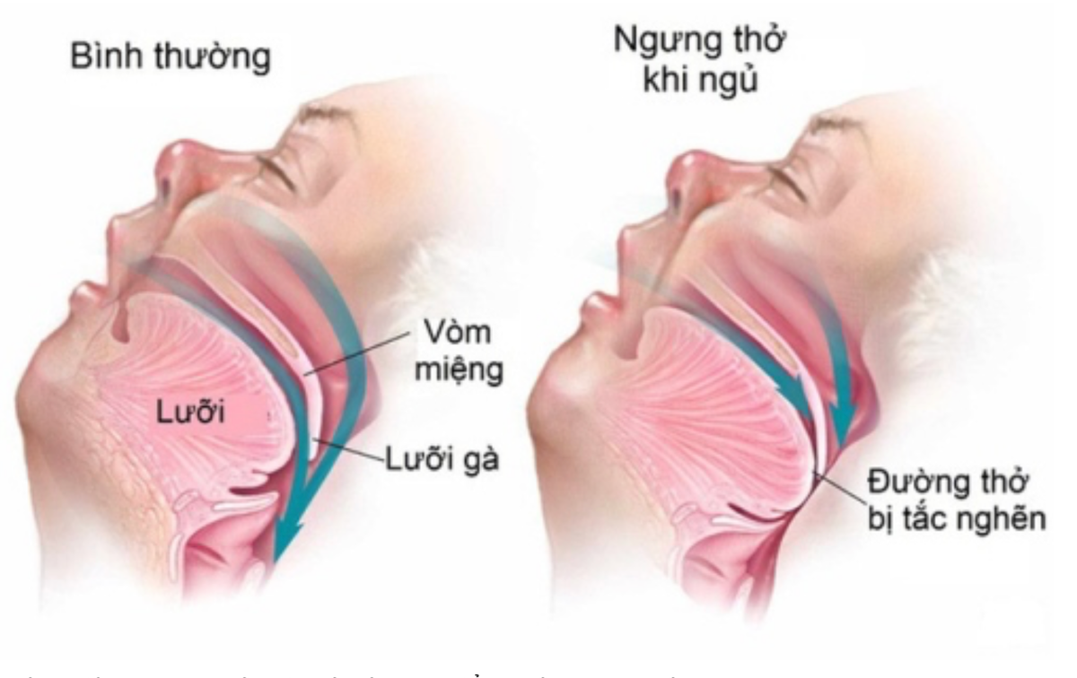 Ảnh chụp Màn hình 2024-11-08 lúc 16.34.33