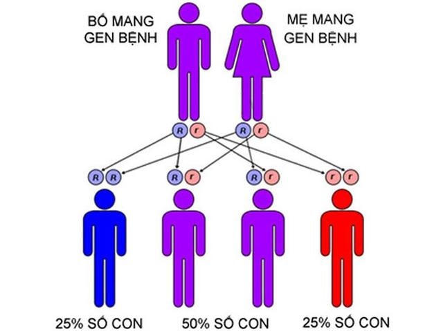 Cơ chế di truyền của bệnh teo cơ tủy. Ảnh: BVCC.  