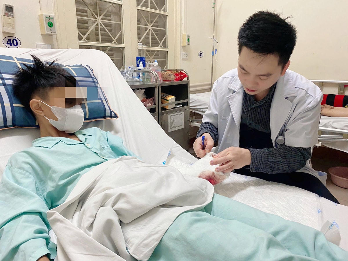 Bác sĩ của Bệnh viện Việt Đức thăm khám cho một trường hợp tai nạn vì pháo tự chế. Ảnh: BVCC