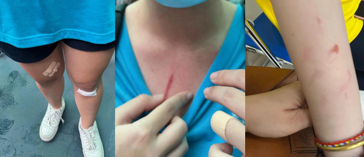 Hình ảnh nữ sinh bị đánh tại Trường Quốc tế TP HCM.