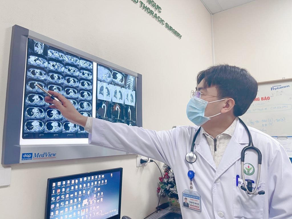 Lóc động mạch chủ type A cấp tính là một trong những nguyên nhân chính gây đột tử ở người khỏe mạnh. Ảnh: BV Hữu Nghị Việt Đức.