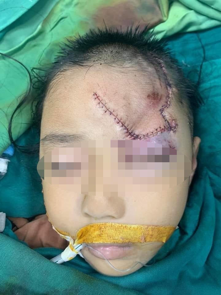 Hiện tình trạng sức khỏe cháu V. ổn định.