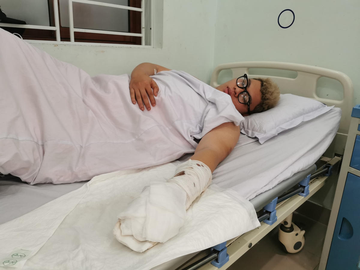 Nạn nhân bị chém lìa 2 ngón tay điều trị tại cơ sở y tế.