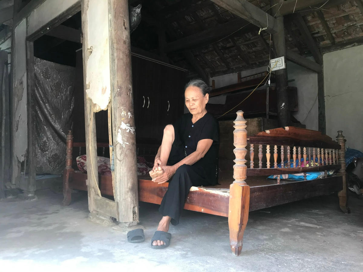 Đôi chân tật nguyền, bước đi bấp bênh như chính chủ nhân Nguyễn Thị Thỉ.