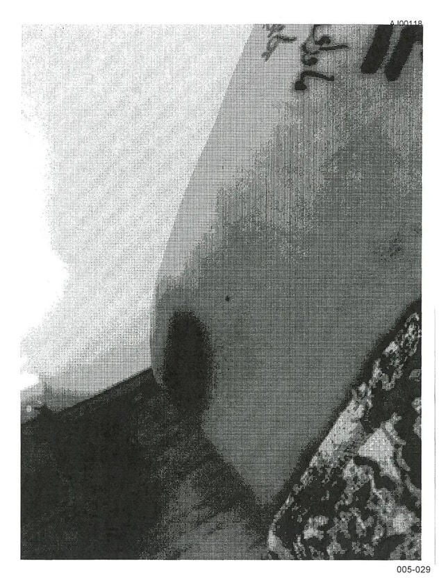 Bản in đen trắng những bức ảnh được cho là chụp thương tích của Angelina Jolie.   