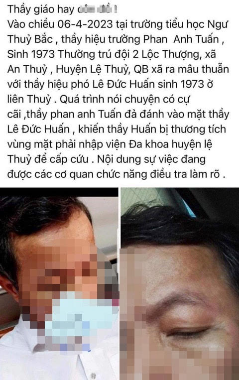 Vụ Hiệu trưởng đánh Hiệu phó nhập viện được đăng lên mạng xã hội khiến dư luận quan tâm (ảnh chụp màn hình).