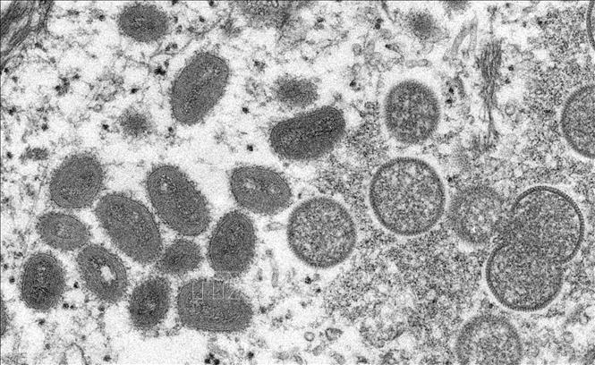 Virus gây bệnh đậu mùa khỉ (ảnh chụp qua kính hiển vi) tại Trung tâm kiểm soát và ngăn ngừa bệnh dịch CHDC Congo. Ảnh: AFP/TTXVN.