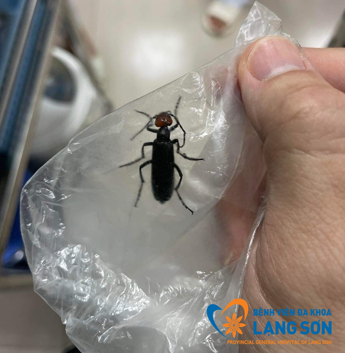 Sâu Ban Miêu do người nhà bệnh nhân mang đến Bệnh viện. Ảnh: Bệnh viện Đa khoa tỉnh Lạng Sơn.