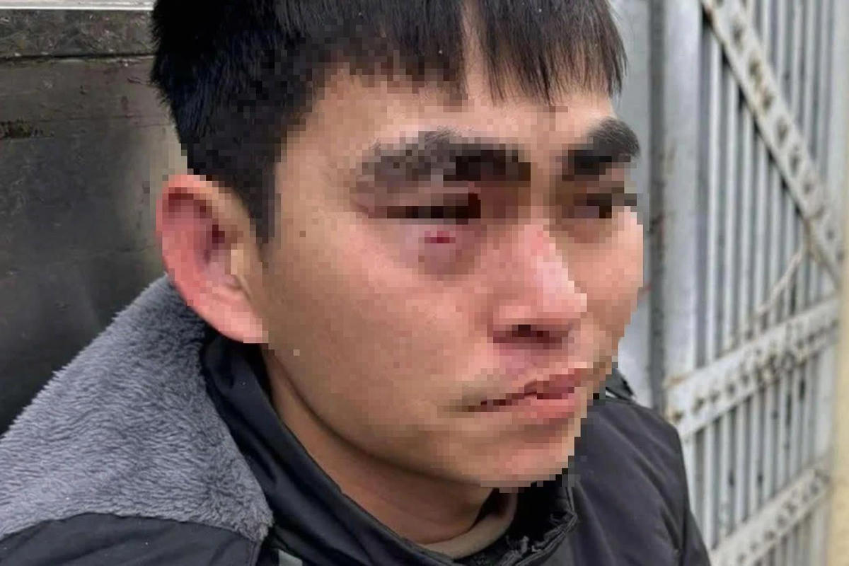 Nam shipper sau khi bị hành hung.