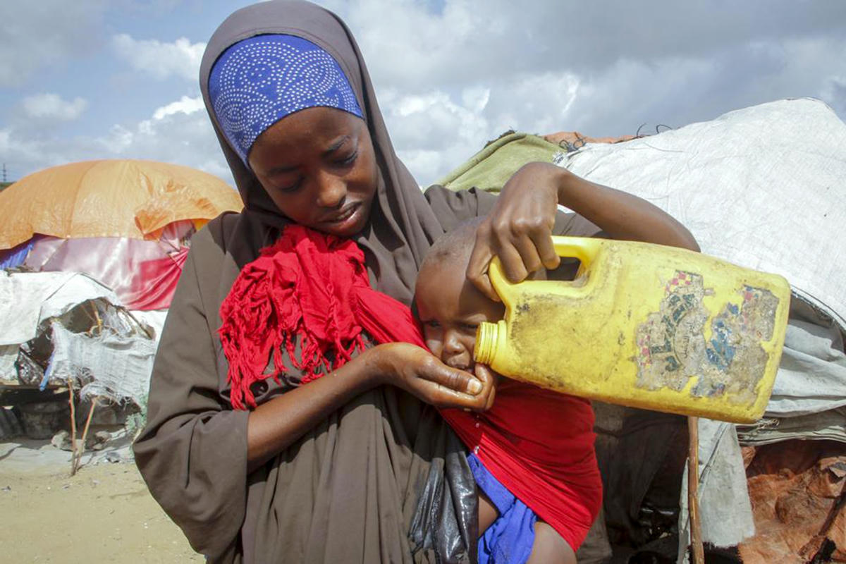 Somalia đang chứng kiến tỷ lệ trẻ em bị suy dinh dưỡng nghiêm trọng tăng gấp 3 lần trong năm nay. Ảnh: AP.