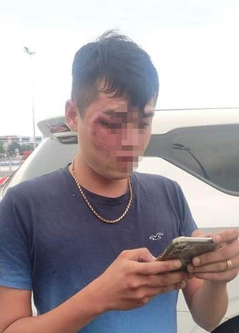 Lái xe ô tô Grab bị hành hung.