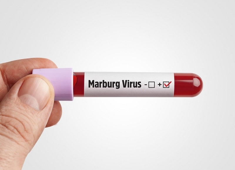 Hiện vẫn chưa có vaccine để dự phòng và thuốc điều trị đặc hiệu bệnh Marburg.