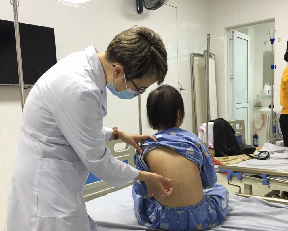 Thăm khám cho trẻ mắc viêm da cơ địa tại Bệnh viện Da liễu trung ương. Ảnh: BVCC.