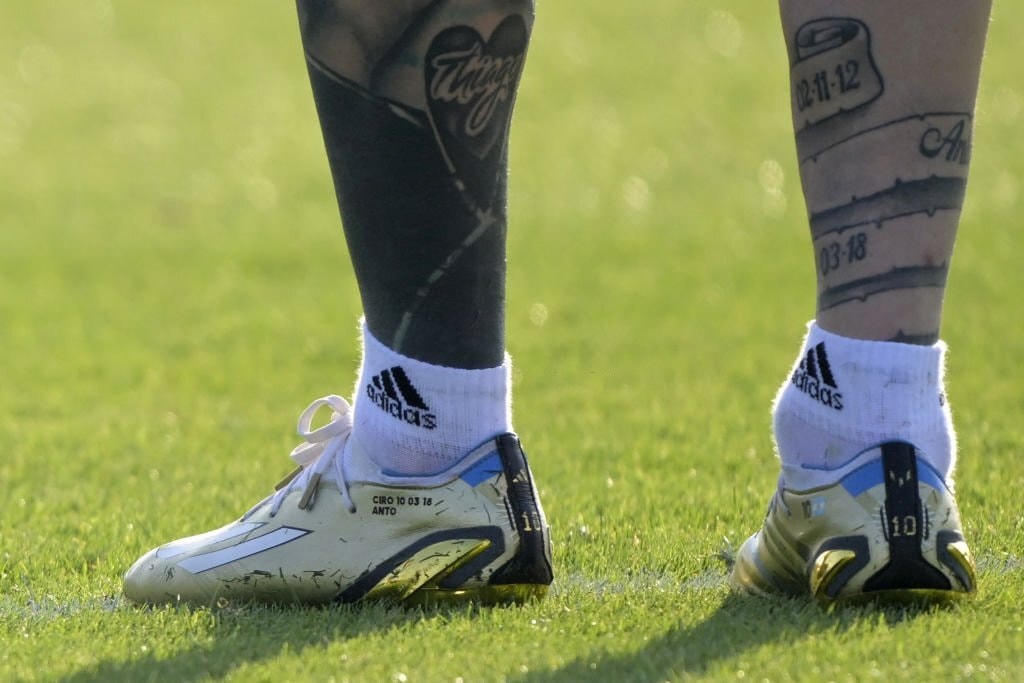 Hình ảnh cổ chân sưng vù của Messi gần đây khiến người hâm mộ lo lắng, nhưng anh cho biết đây chỉ là biện pháp bảo vệ với keo lạnh để tránh chấn thương. Ảnh: Getty.