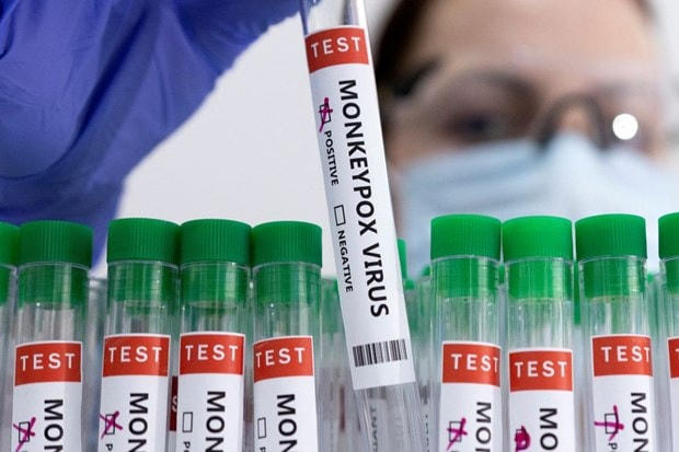 Xét nghiệm bệnh đậu mùa khỉ. Nguồn: Reuters