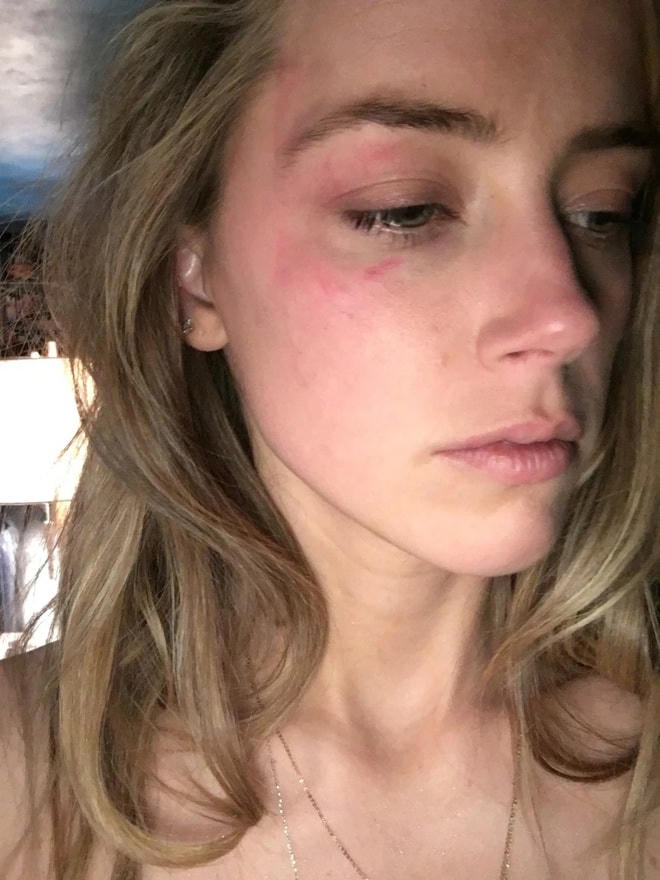 Amber Heard tung bằng chứng tố chồng bạo hành.