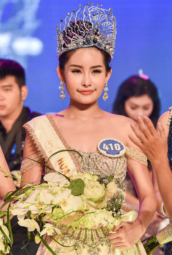 Lê Âu Ngân Anh từng phẫu thuật nâng mũi khiến dư luận một phen bức xúc.