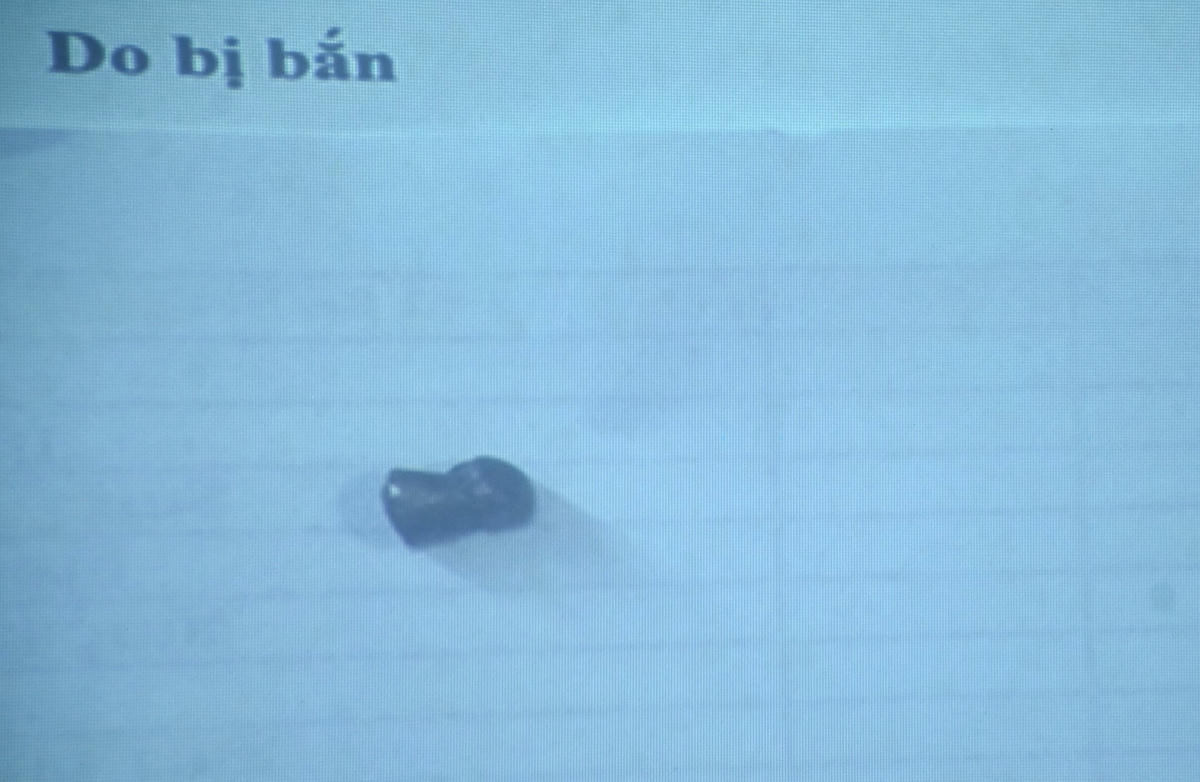Viện đạn được lấy từ người 2 công nhân vệ sinh môi trường.