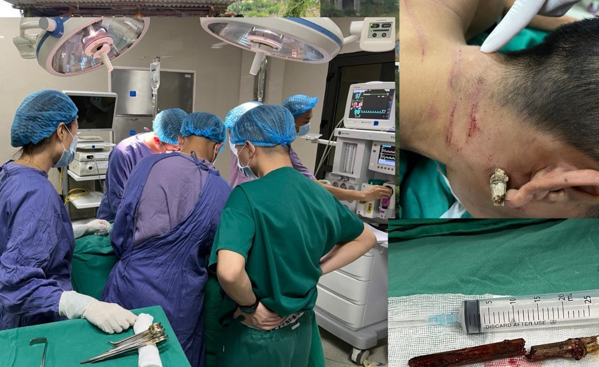 Các bác sĩ đã phẫu thuật thành công và cứu sống được bệnh nhân