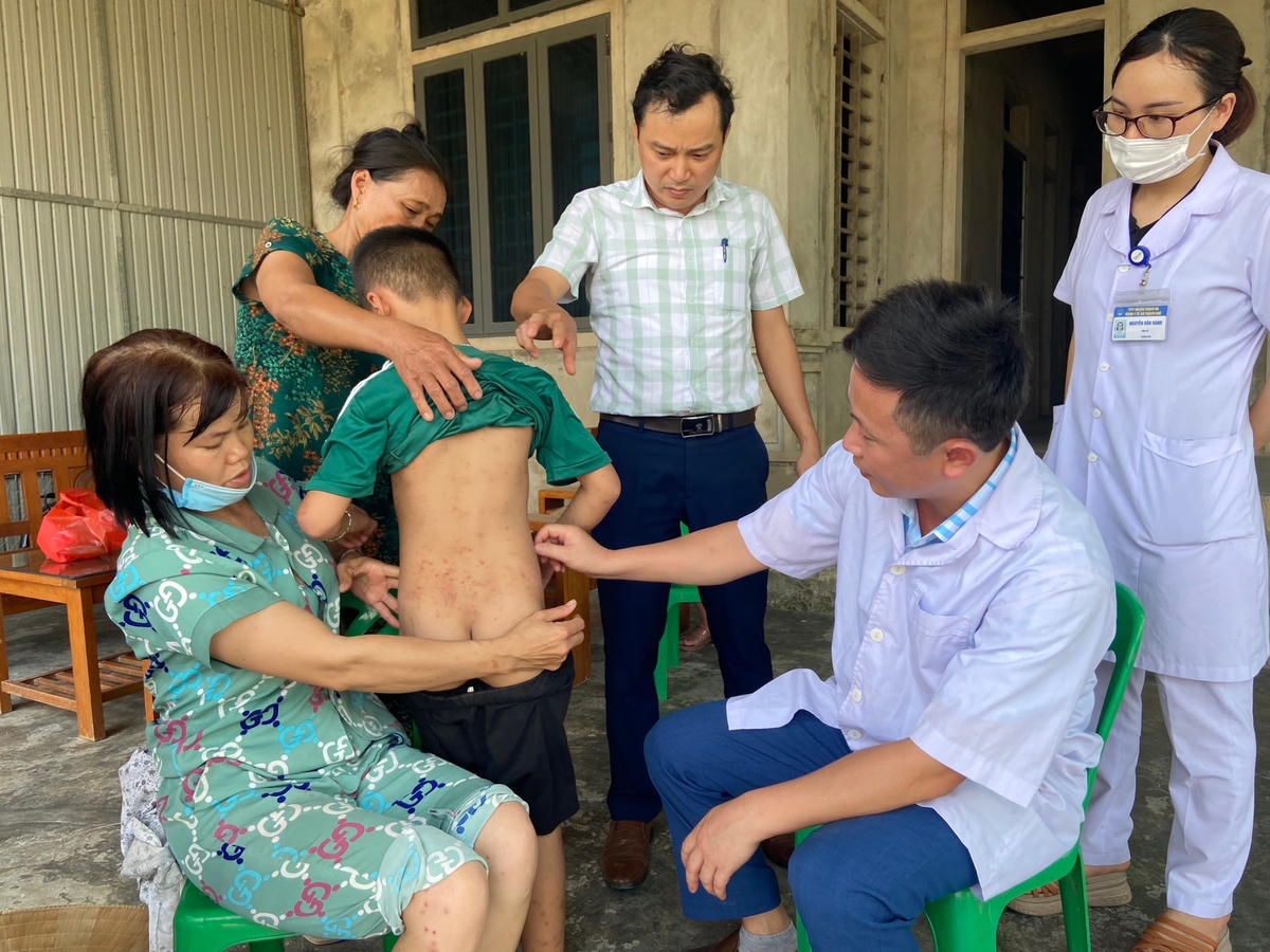 Theo điều tra ban đầu, toàn xã Thạch Khê hiện có 46 hộ gia đình với 126 người bị loài côn trùng trên cắn đốt gây sẩn ngứa, dị ứng da.