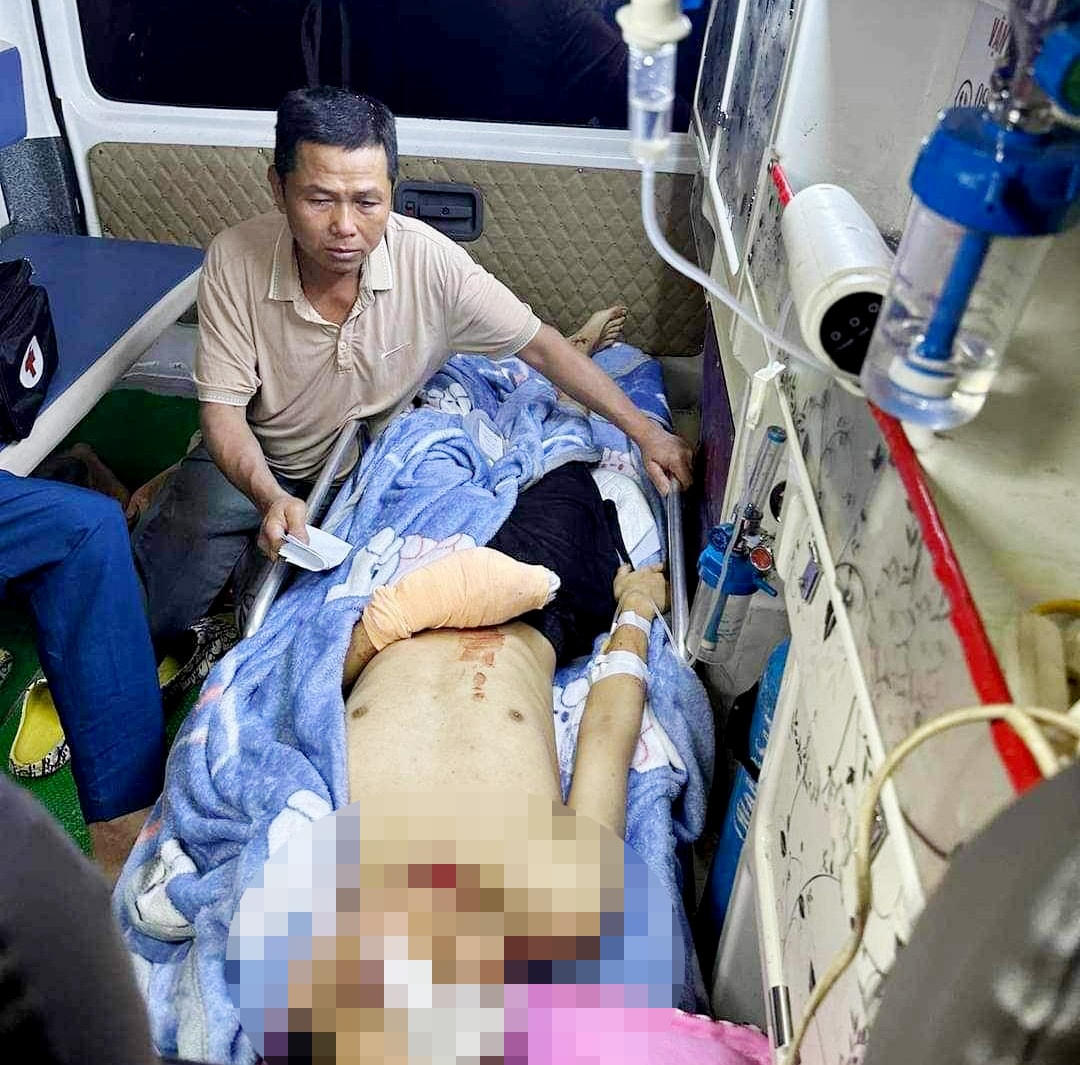 Do bị thương nặng nên em T. được đưa đi cấp cứu tại bệnh viện Trung ương Huế.