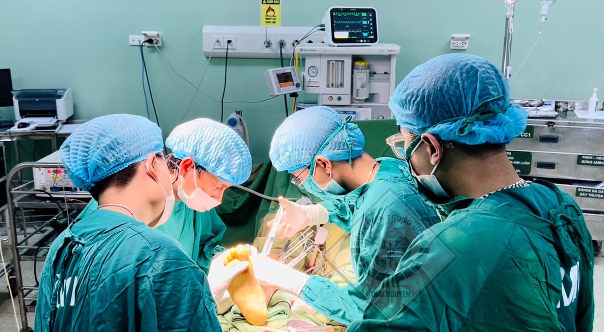 Bác sĩ CKII.Nguyễn Thanh Tùng (thứ hai từ trái qua) cùng kíp phẫu thuật cấp cứu cho hai bệnh nhi bị máy cắt cỏ cắt gần đứt lìa cẳng chân phải. Ảnh: BVCC