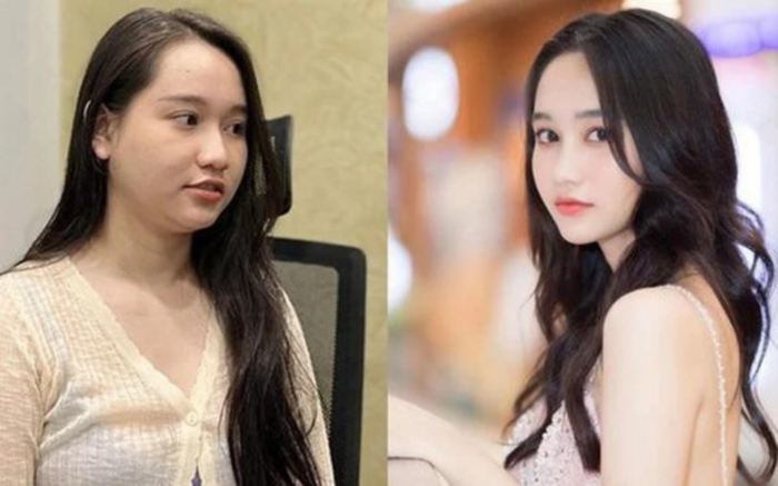 Diễn viên Trúc Anh bị đồn có bầu vì gặp vấn đề về sức khỏe. 