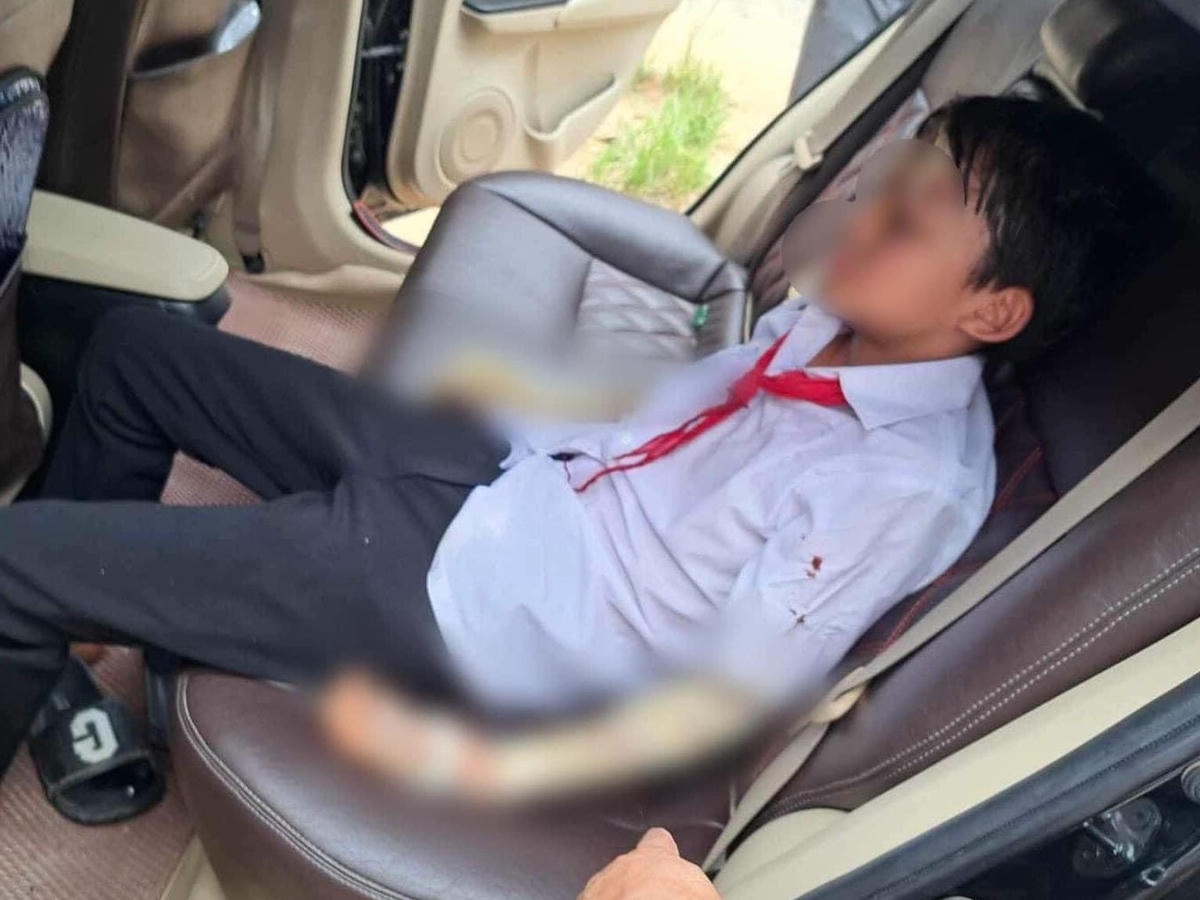 Học sinh bị thương được đưa lên xe để đi cấp cứu.