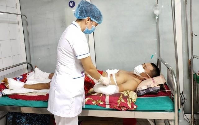 Bệnh nhân phải cắt cụt tay vì đắp thuốc nam trị bỏng. Ảnh: BV Đa khoa tỉnh Tuyên Quang.