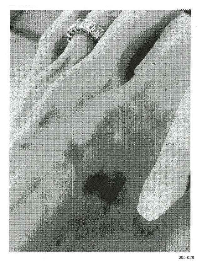 Bản in đen trắng những bức ảnh được cho là chụp thương tích của Angelina Jolie.     