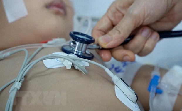 Thăm, khám cho trẻ mắc tay chân miệng. Ảnh: TTXVN.