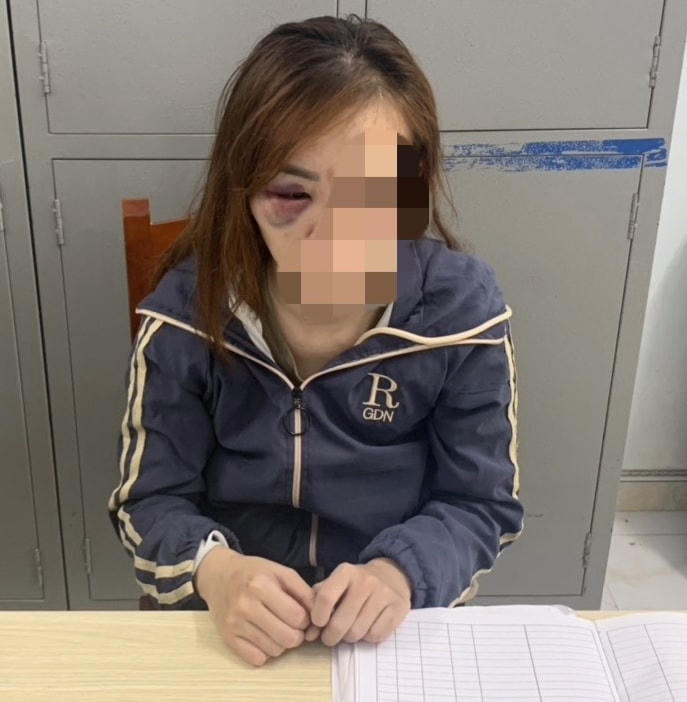 Chị Đ. bị đánh đập gây thương tích trên vùng mặt.