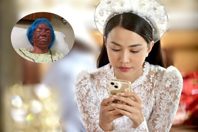 Trong "Trên cả tình thân", Thiên Nga có phân cảnh gặp tai nạn dẫn đến biến đổi gương mặt.