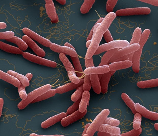 Vi khuẩn Burkholderia pseudomallei. (Nguồn: NPR).