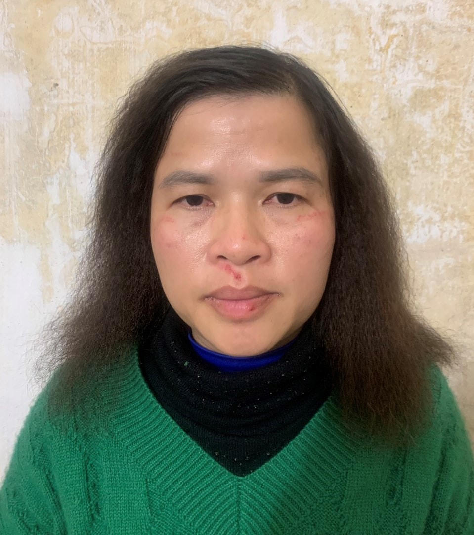 Đối tượng Nguyễn Thị Ái Liên.