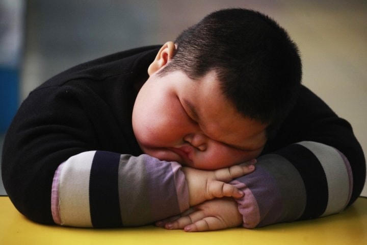 Trẻ béo phì đang có xu hướng tăng.