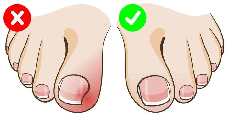 Hơn 10 sai lầm vệ sinh cá nhân mà mọi người mắc phải hàng ngày
