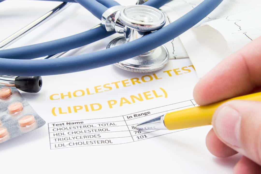 Cholesterol - Một nghiên cứu gần đây tuyên bố rằng uống sữa có thể giúp kiểm soát bệnh béo phì và bệnh tiểu đường, đồng thời kiểm soát mức cholesterol trong máu.