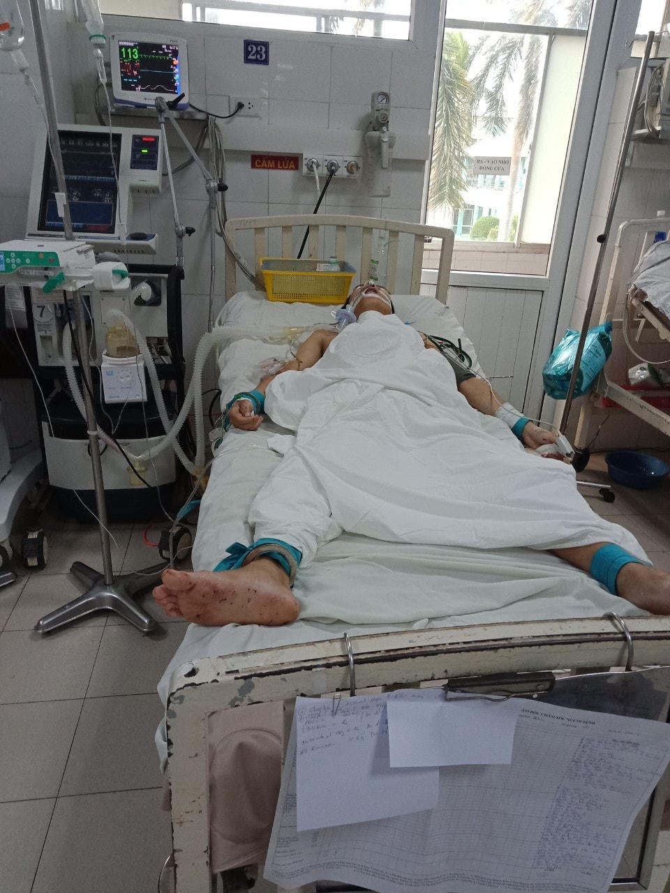 Nghi phạm Họp đang nằm điều trị tại bệnh viện.