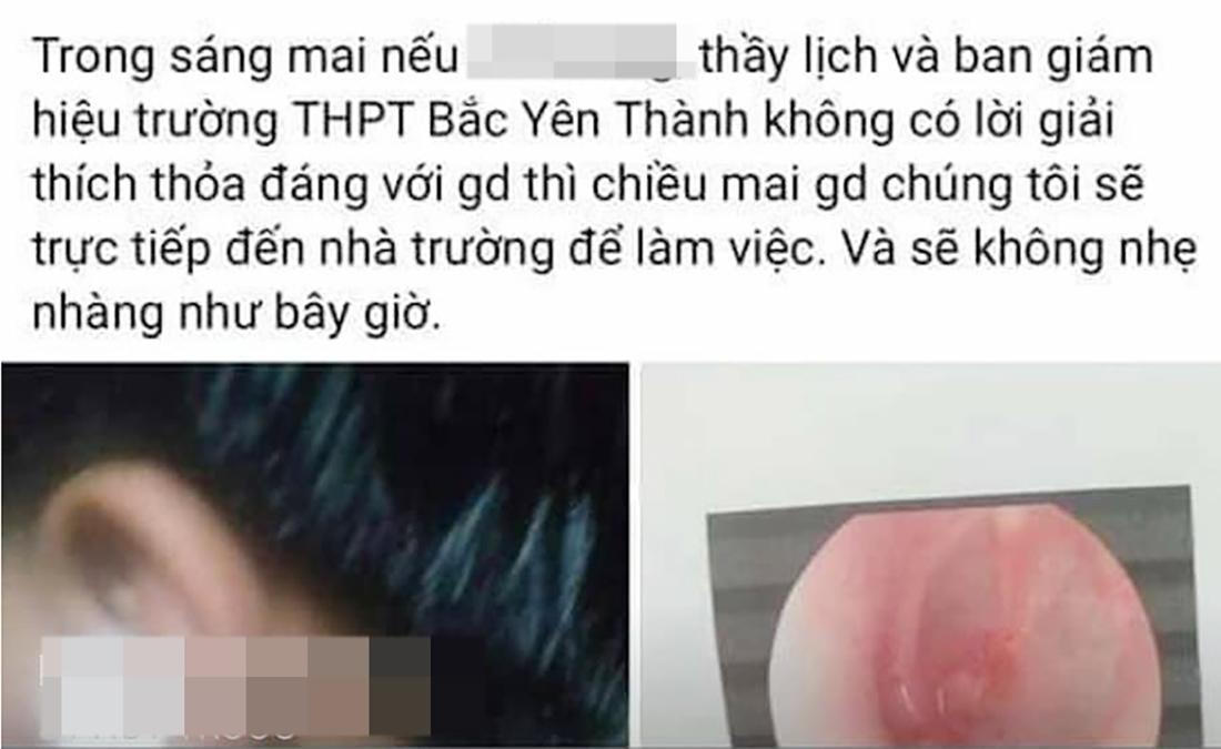 Nội dung chia sẻ trên mạng xã hội về việc 1 nam sinh lớp 10 bị thầy giáo tát trong giờ học.