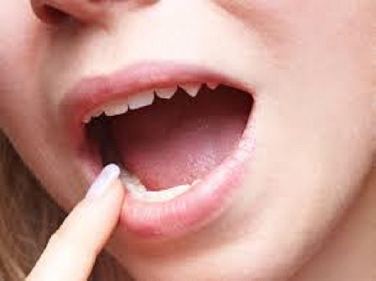 15 dấu hiệu cảnh báo bệnh tiểu đường ở phụ nữ ngoài 40