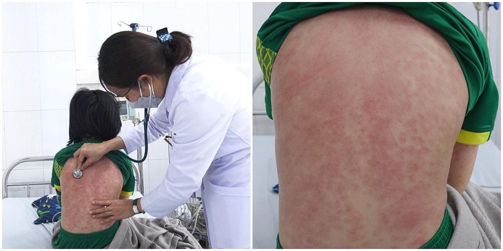 Bác sĩ Bệnh viện Bãi Cháy khám cho trường hợp bệnh nhi mắc hội chứng MIS-C hiếm gặp/hậu Covid-19. Ảnh: QMG.