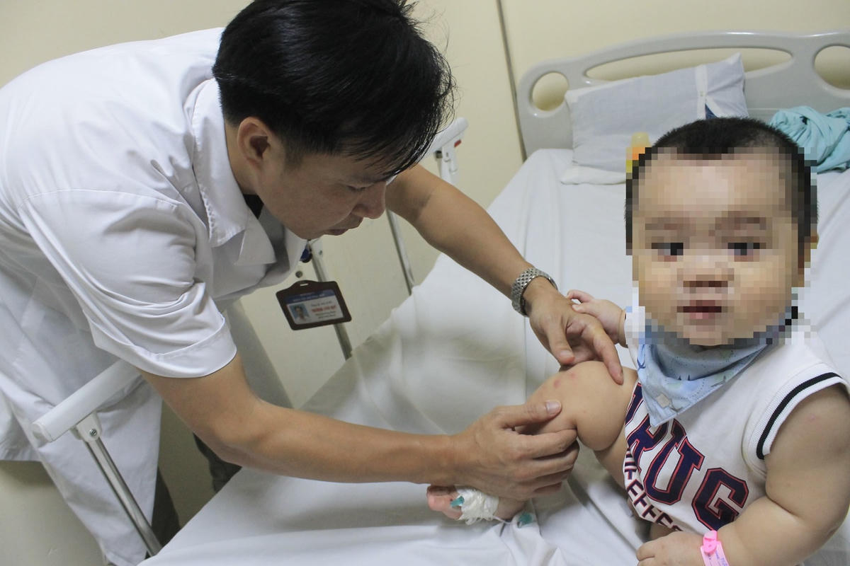 Thời tiết nắng nóng bất thường, khiến trẻ em mắc các bệnh mùa hè gia tăng.
