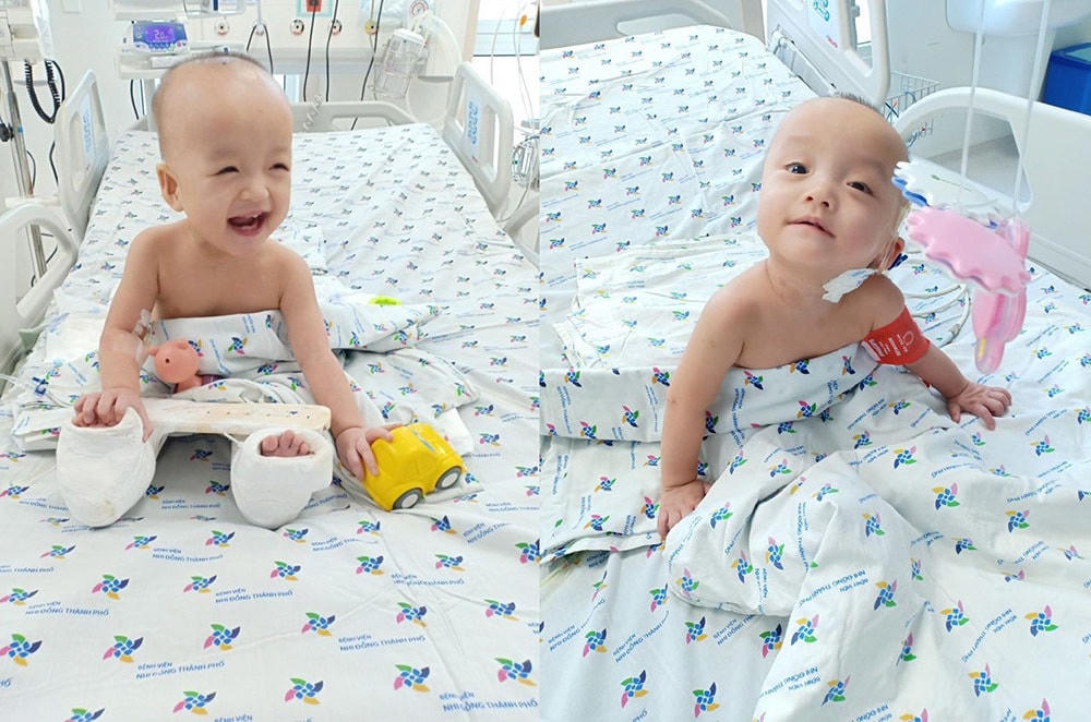 Hai bé Trúc Nhi và Diệu Nhi sau ca phẫu tách đôi cực kỳ nổi tiếng.