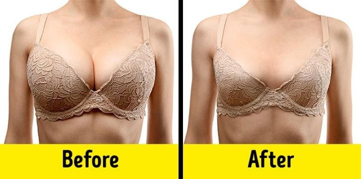[ẢNH] Rối loạn nội tiết tố 'phá' ngoại hình của bạn như thế nào?